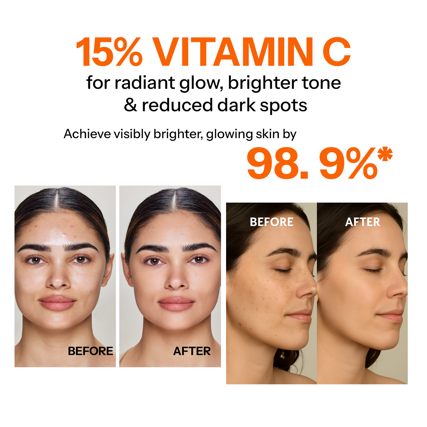 DA POSH Vitamin C Brightening Face Serum | Fades Dark Spots & Boosts Radiance
