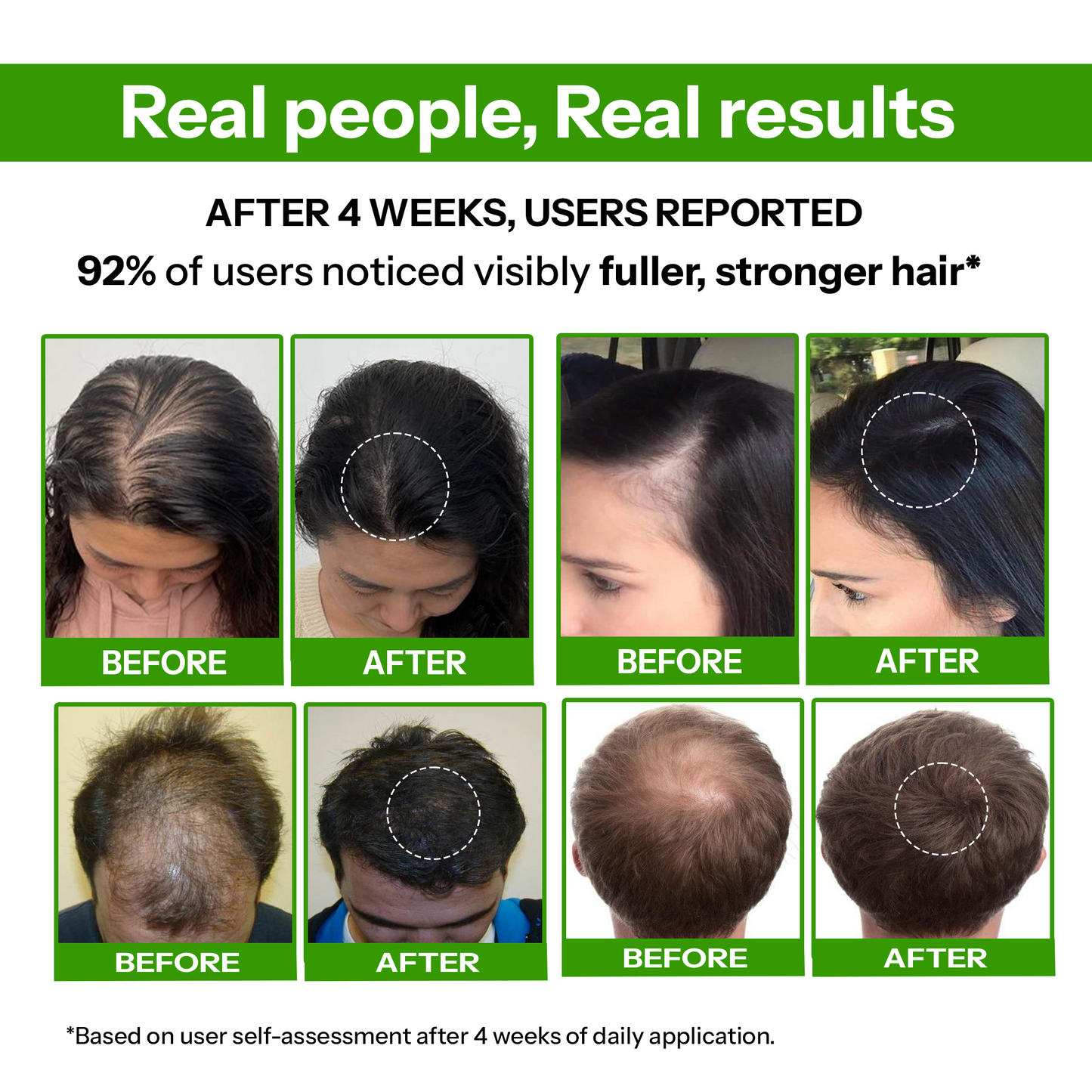 Daposh Hair Growth Serum – Strengthen, Repair & Grow