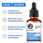 Daposh Niacinamide 5% Acne Serum – Clearer Skin, Balanced Pores